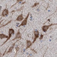 HPA IHC Cerebral cortex — GPAT3