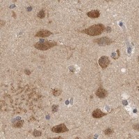 HPA IHC Cerebral cortex — CCT8