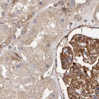 HPA IHC Kidney — TMC7