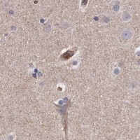 HPA IHC Cerebral cortex — TMC7