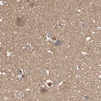 HPA IHC Cerebral cortex — PKM