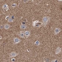 HPA IHC Cerebral cortex — SIRT4