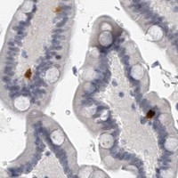 HPA IHC Colon — TFCP2L1
