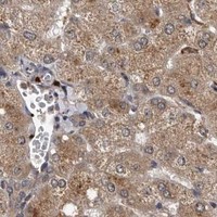 HPA IHC Liver — PMVK