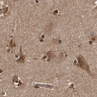 HPA IHC Cerebral cortex — PMVK