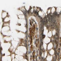 HPA IHC Colon — LAMTOR1