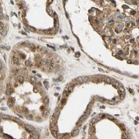 HPA IHC Kidney — LAMTOR1