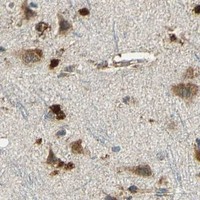 HPA IHC Cerebral cortex — LAMTOR1