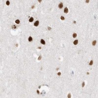 HPA IHC Cerebral cortex — SMARCA2