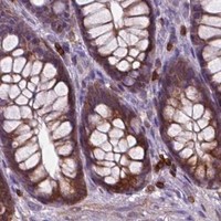 HPA IHC Colon — BCL2