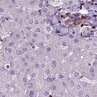 HPA IHC Liver — BCL2