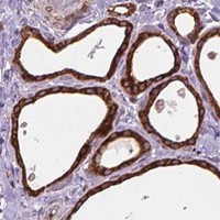 HPA IHC Thyroid gland — BCL2