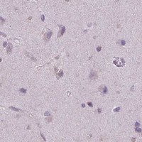 HPA IHC Cerebral cortex — BCL2