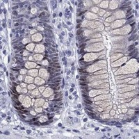 HPA IHC Colon — CDCA2