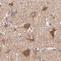 HPA IHC Cerebral cortex — DLST