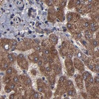 HPA IHC Liver — BNIP3