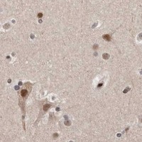 HPA IHC Cerebral cortex — ATF5