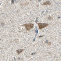 HPA IHC Cerebral cortex — STX18