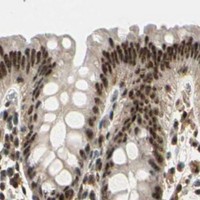 HPA IHC Colon — RBM25