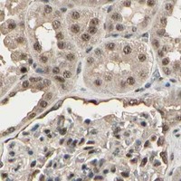 HPA IHC Kidney — RBM25