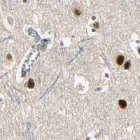 HPA IHC Cerebral cortex — RBM25