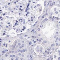 HPA IHC Kidney — MCM2