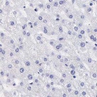 HPA IHC Liver — MCM2