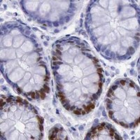 HPA IHC Colon — MCM2