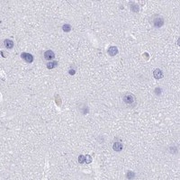 HPA IHC Cerebral cortex — MCM2