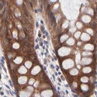 HPA IHC Colon — BAIAP2L2