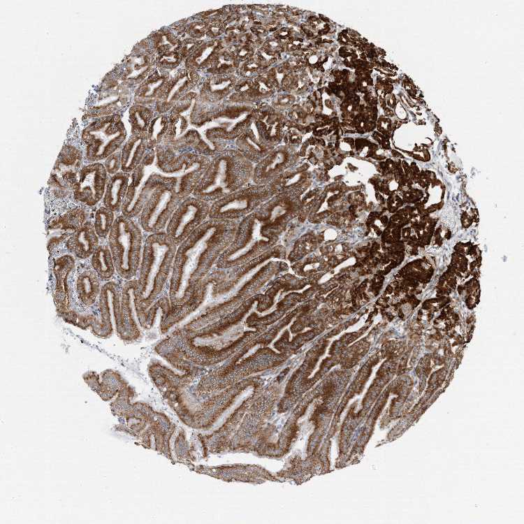 Tissue expression of RPL26L1 - Staining in stomach - The Human Protein Atlas