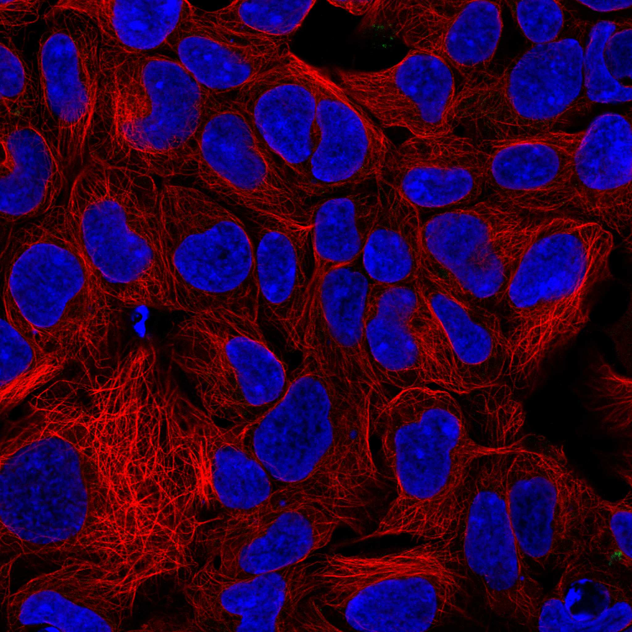 Subcellular AIFM1 The Human Protein Atlas