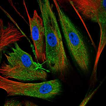 HPA030665: BJ [Human fibroblast]