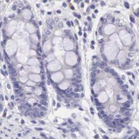 HPA IHC Colon — BCL6