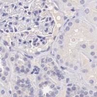 HPA IHC Kidney — BCL6