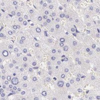 HPA IHC Liver — BCL6
