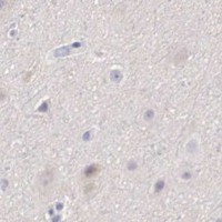 HPA IHC Cerebral cortex — BCL6