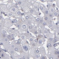 HPA IHC Liver — TMX1