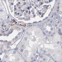 HPA IHC Kidney — TMX1