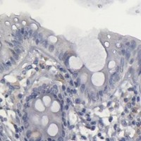 HPA IHC Colon — TMX1