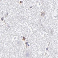 HPA IHC Cerebral cortex — TMX1