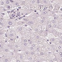 HPA IHC Liver — STEAP1