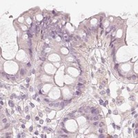 HPA IHC Colon — STEAP1