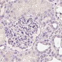 HPA IHC Kidney — STEAP1