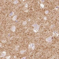 HPA IHC Cerebral cortex — STEAP1