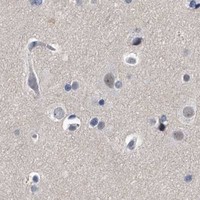 HPA IHC Cerebral cortex — CRISP2