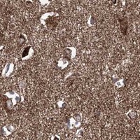 HPA IHC Cerebral cortex — SEMA6A