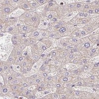 HPA IHC Liver — SORL1