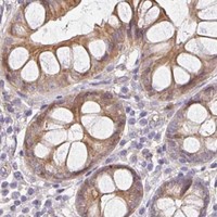 HPA IHC Colon — SORL1