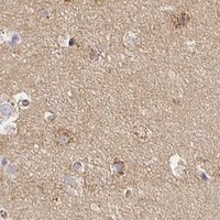HPA IHC Cerebral cortex — SORL1
